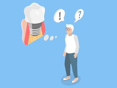 Are You a Candidate for Dental Implants in Mississauga